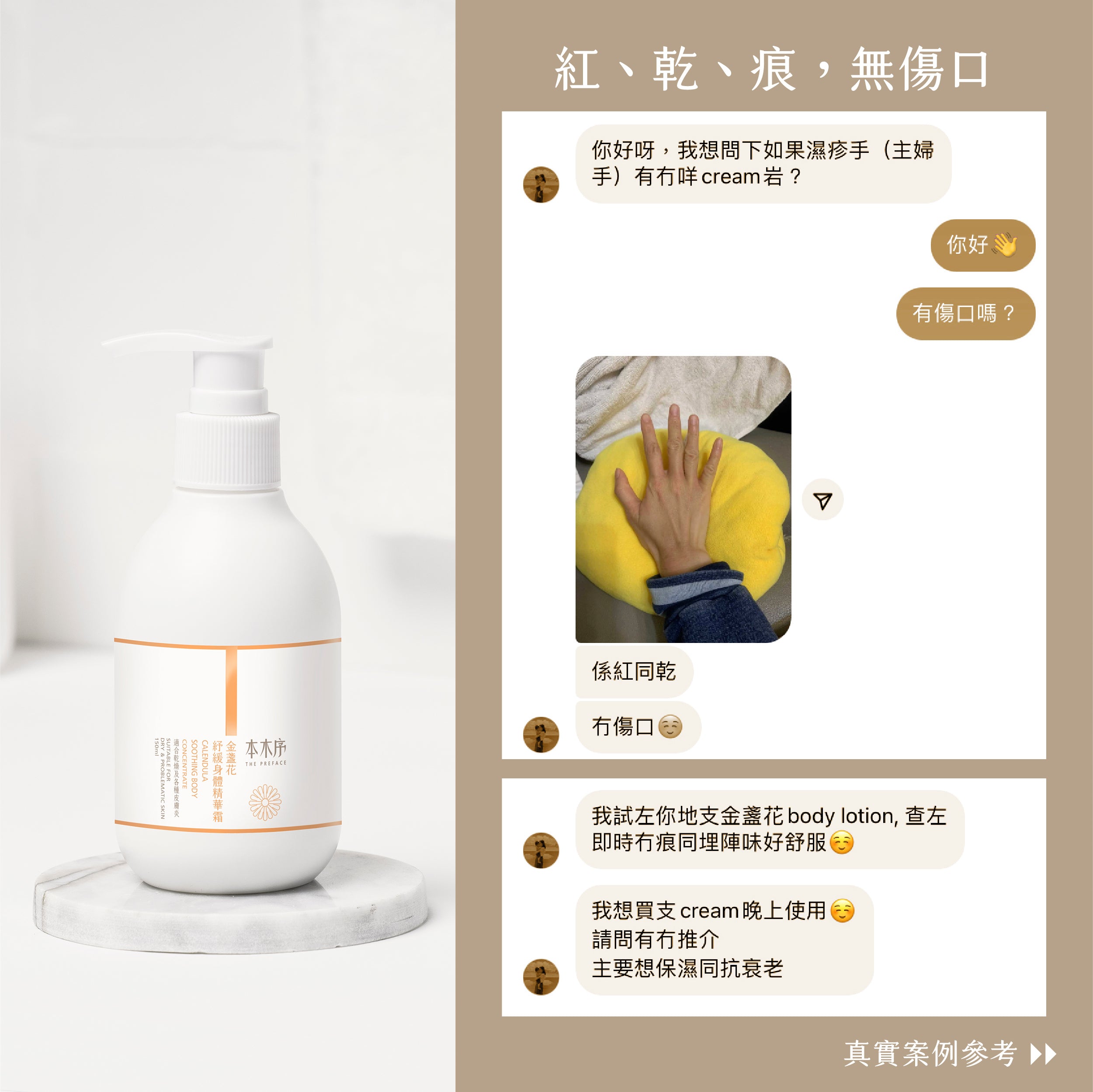 2023 XMAS 金盞花身體紓緩套裝